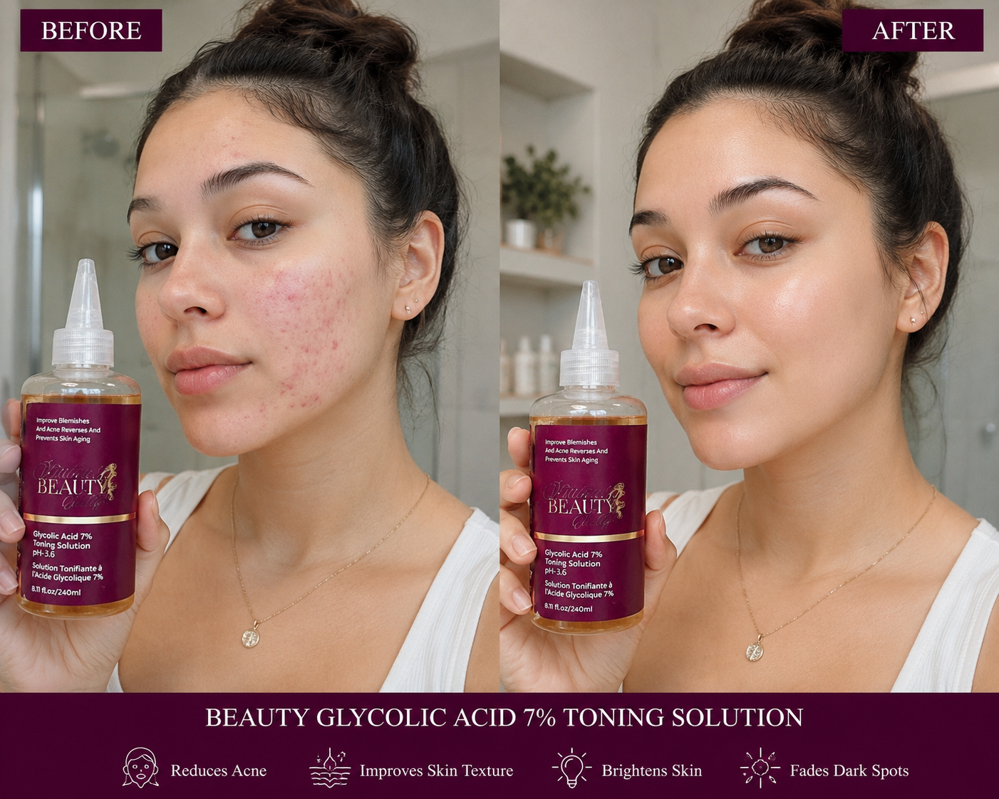 Acne Clearing Glycolic Acid 7% Toner – Unisex Face Toner for Pimples, Dark Spots & Smoother Skin – 240ml
